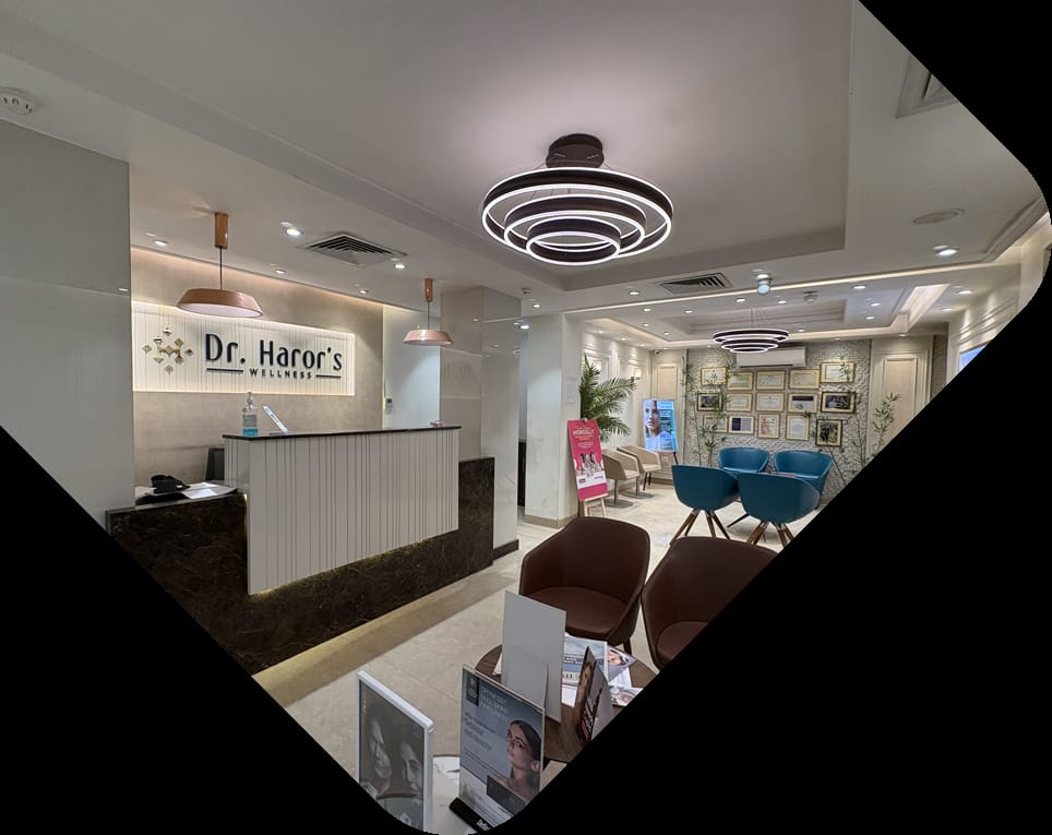 Before Melasma & Pigmentation Correction in Ahmedabad